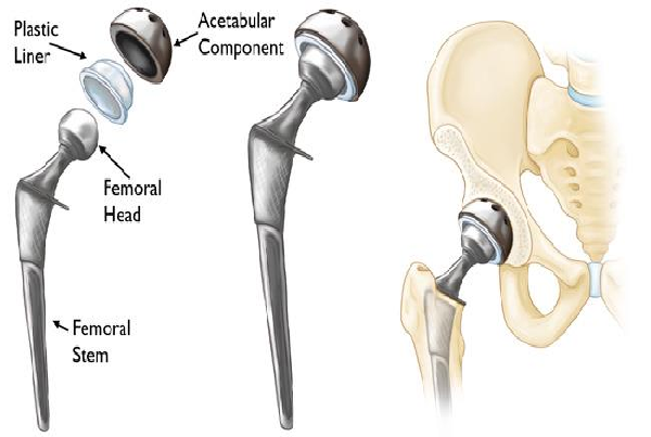 best Orthopedic treatment